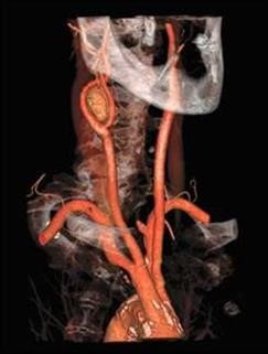 "viagra.com Buy Here Pay Here Car